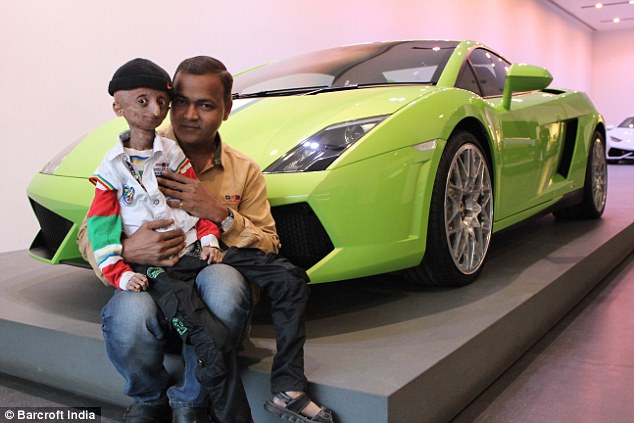 Nihal, with his father Srinivas, posing beside a Lamborghini in Mumbai. Progeria is very rare, with between 200 to 250 children living with the syndrome at any given time